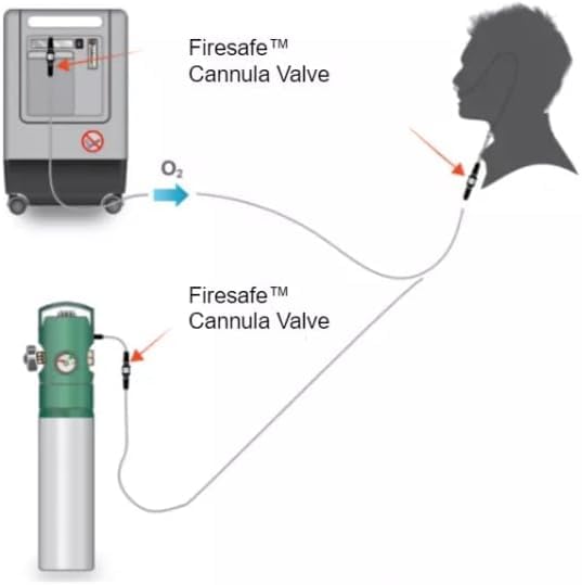 Sunset Firesafe Thermal Shut-Off Valve Kit